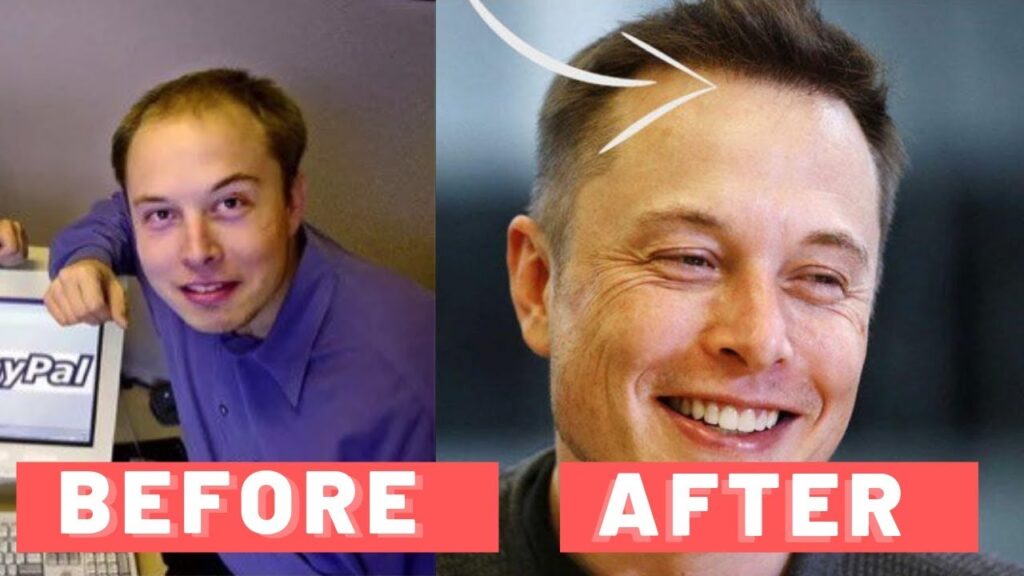 elon_musk_hair